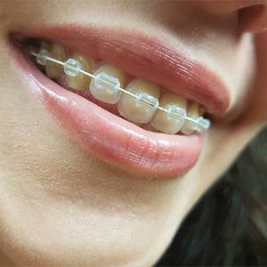 Tratamientos Adeslas Dental MAX